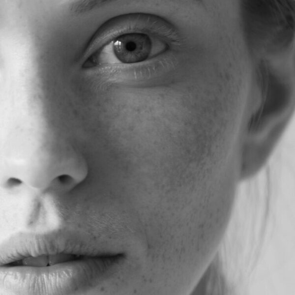 Corrective Retinoid Therapy