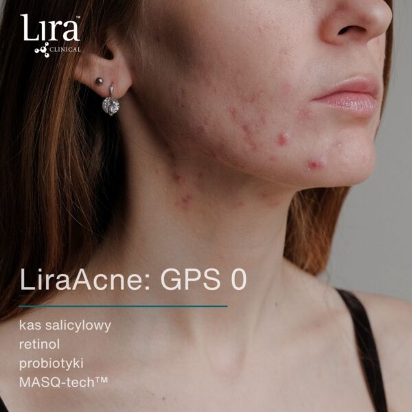 LIRA ACNE