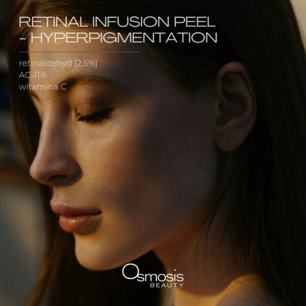 RETINAL INFUSION PEEL - HYPERPIGMENTATION