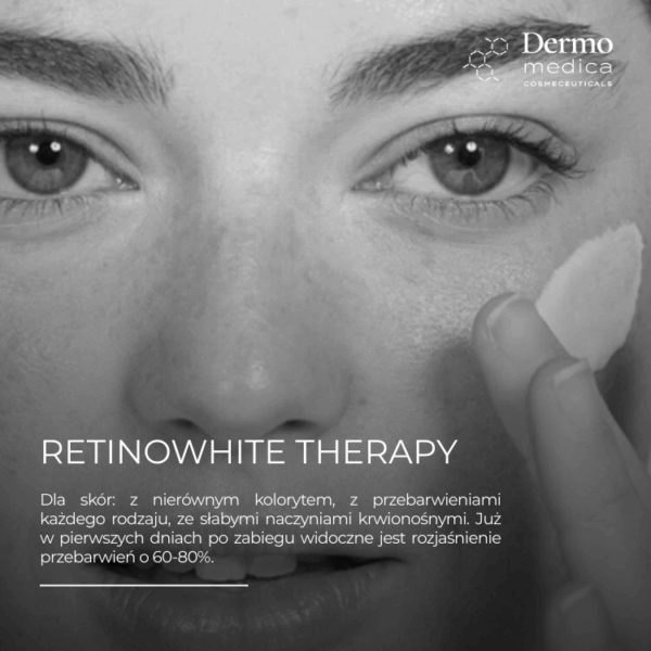 Retinowhite Therapy