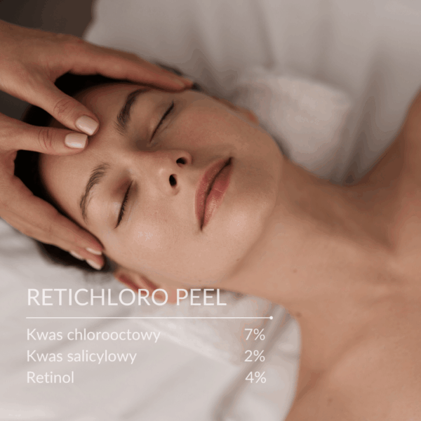Retichloro Peel Dermaquest
